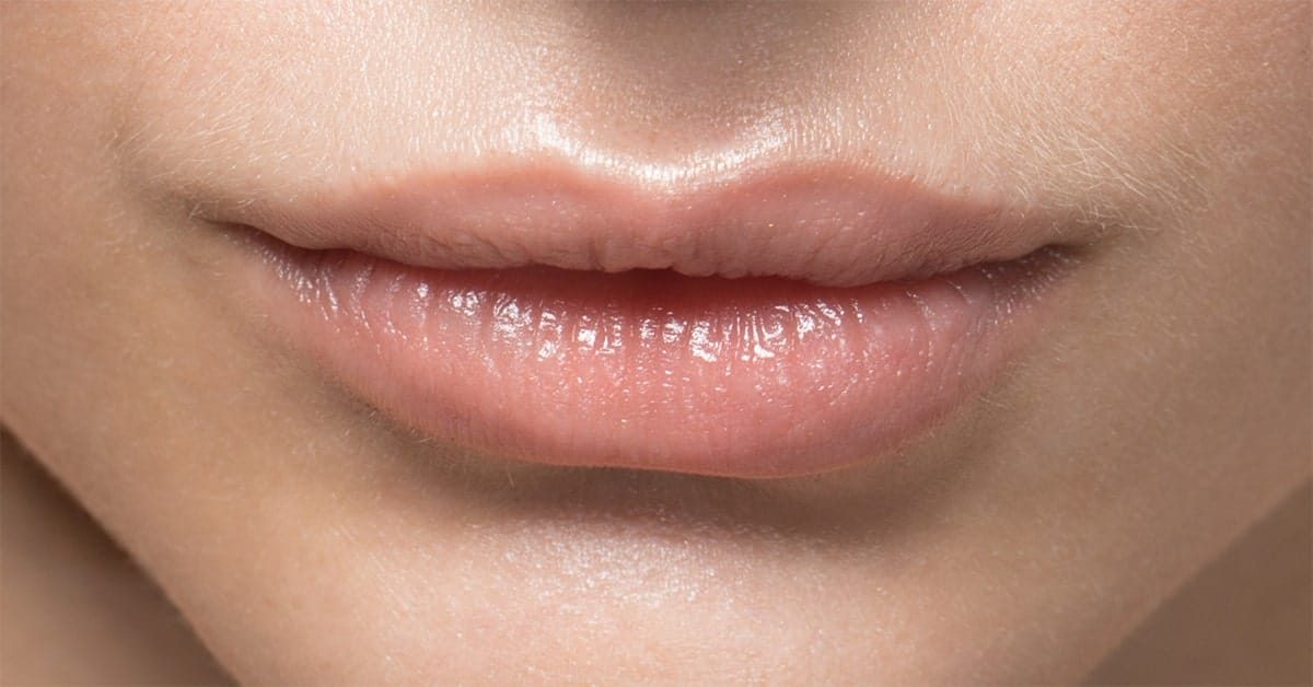 Lippen aufspritzen vorher - nachher ohne Reue